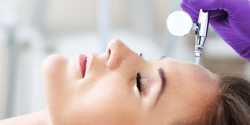 Acne scarring